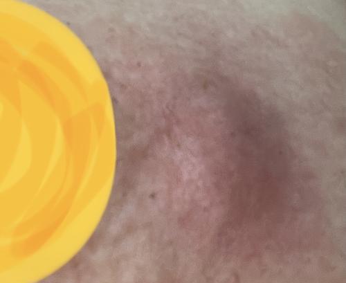母猫乳腺炎的治疗方法(掌握这些方法)