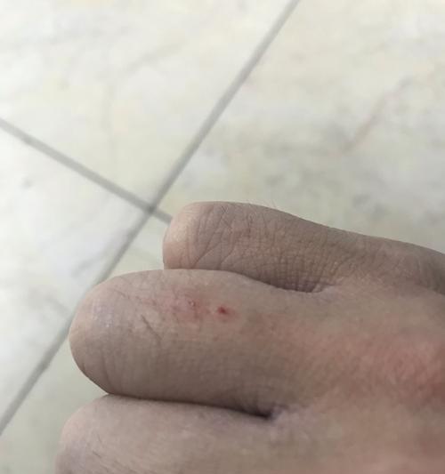 以爱小猫挠用打针，如何保证宠物的安全