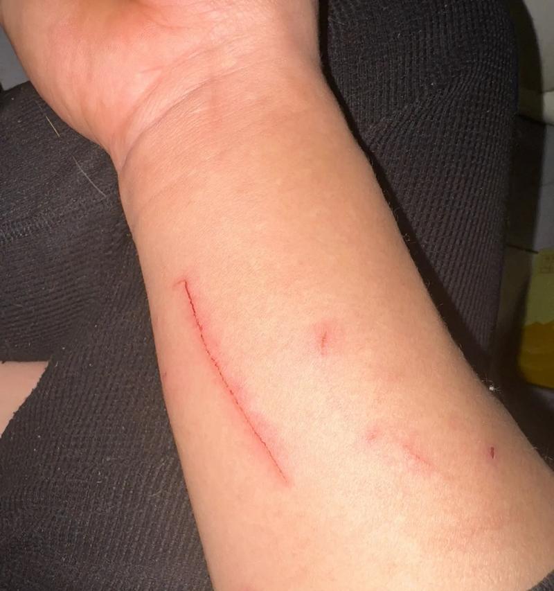 如何应对被猫咪抓伤（宠物抓伤不可忽视）